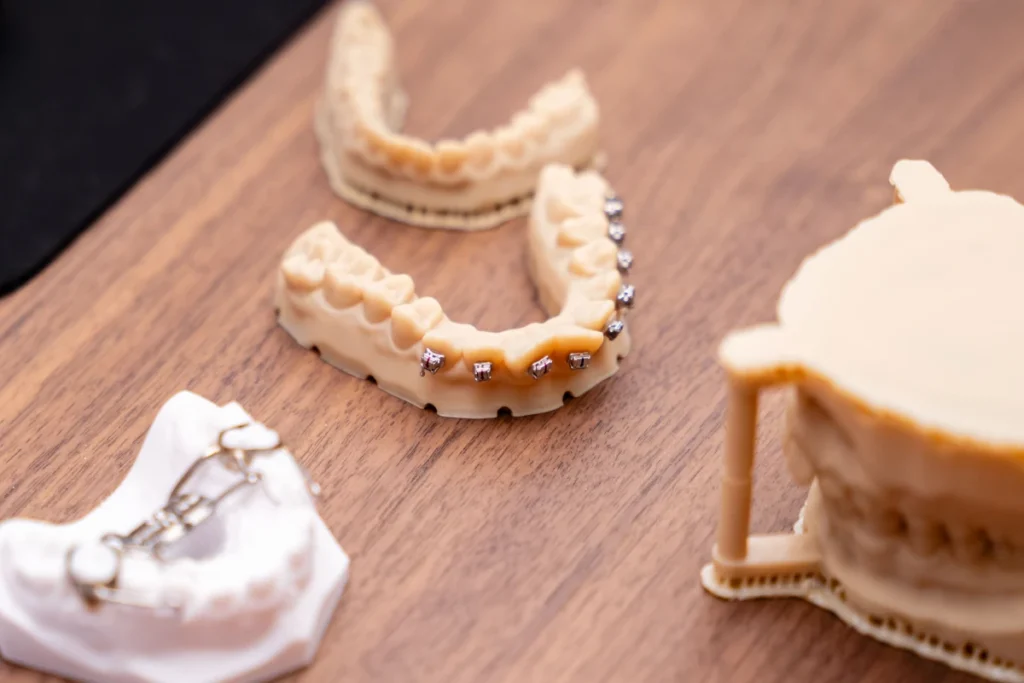 orthodontie gisors laboratoire Traitements Dr Luca MANGIARACINA - Orthodontie Gisors